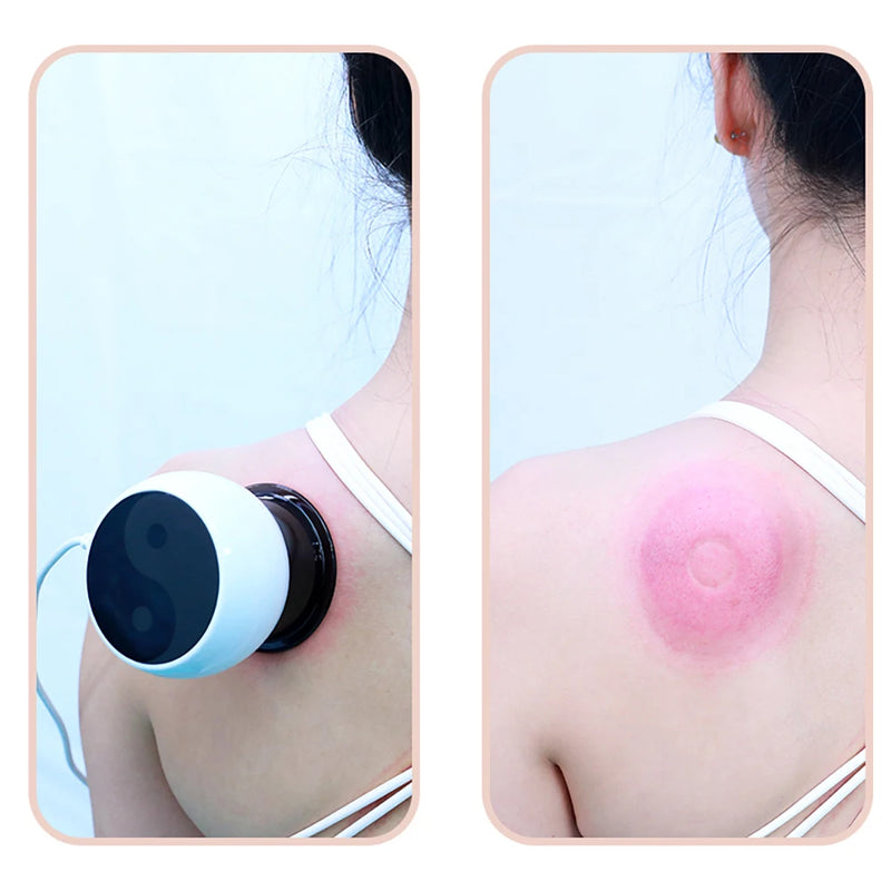 Remote Control Smart Cupping Massage Device